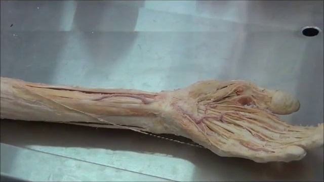 Анатомия. Мышцы и нервы верхней конечности. смотреть онлайн