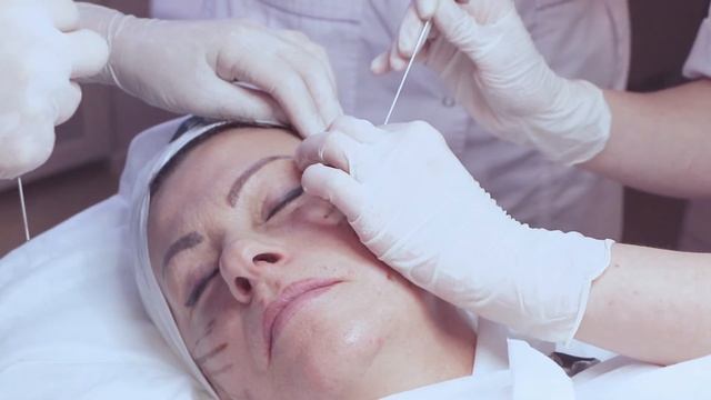 Подтяжка лица велюровыми нитями Cogs смотреть онлайн