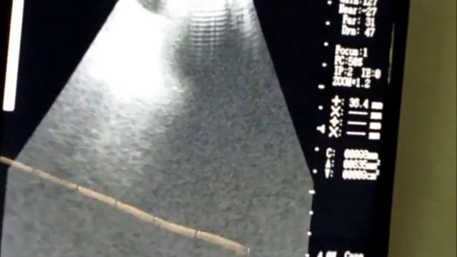 Kai Xin Tunja Boyacá Actual Biotec смотреть онлайн