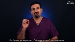 Костная мозоль при ринопластике