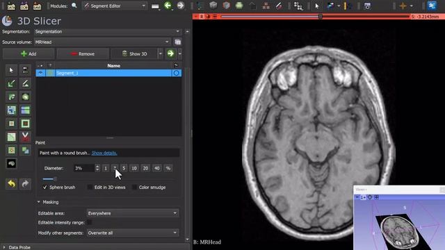 Multi-window layout in 3D Slicer смотреть онлайн