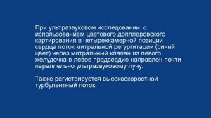 Ультразвуковое исследование сердца
