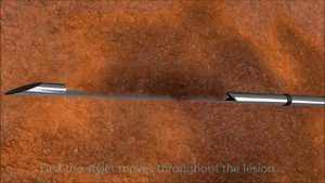 Иглы для биопсии мягких тканей