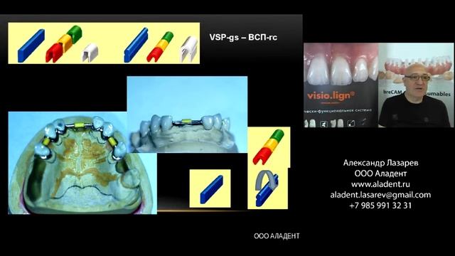 Ретенционные элементы компании bredent (замковые крепления) для фиксации зубных протезов. Часть 9. смотреть онлайн