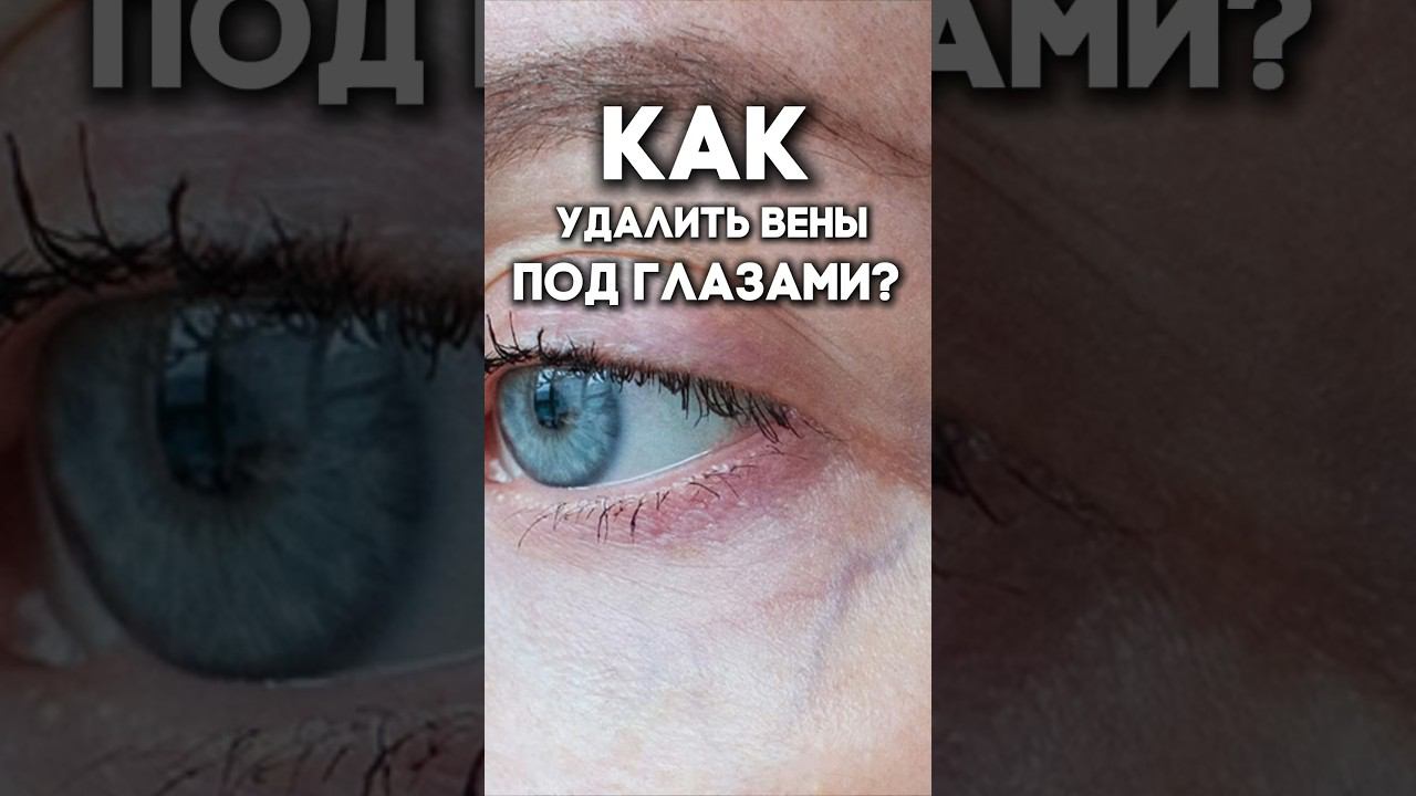 Как удалить вены под глазами?