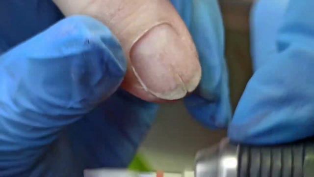 Отслойки, травмированный ноготок😢 смотреть онлайн