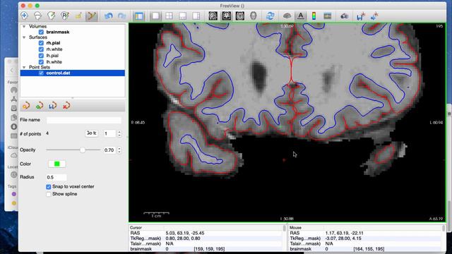 FreeSurfer Control Points | White Matter Intensity Normalization смотреть онлайн