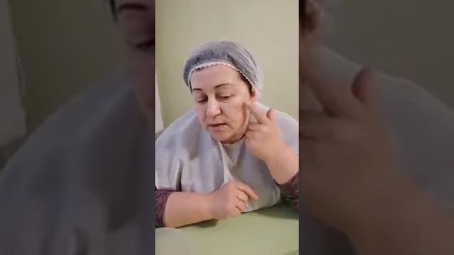 Самый лучший пилинг. Результат. смотреть онлайн