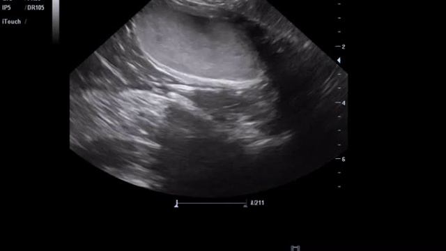 Сat 2 years. Urolithiasis disease. The catheter in the bladder. смотреть онлайн