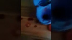 Сломалось рука до костей