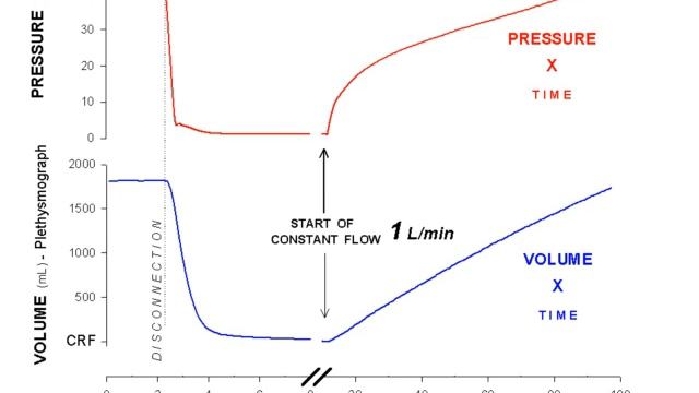Should we always use ct to customize our mechanical ventilation strategy pro M Amato 2011 смотреть онлайн