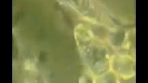 Как лимфоциты убивают раковую клетку онкология