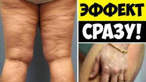 Как избавиться от целлюлита - Домашний краб от целлюлита за 3 мин, рецепт.mp4