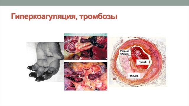 Лекция "Введение. Гомеостаз. Физико-химические свойства крови. Система гемостаза. Группы крови"