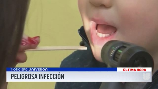 Aumentan los casos de infecciones de garganta en niños por estreptococo tipo A смотреть онлайн