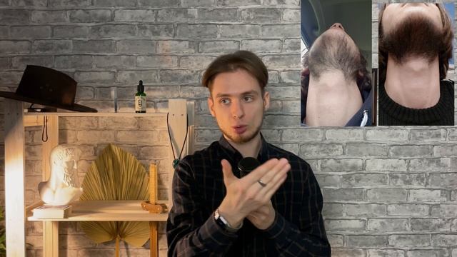 Борода за 60 дней БЕЗ МИНЕКСА? Проверяем... смотреть онлайн