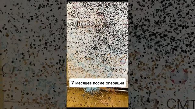 Впечатляющие результаты бариатрической операции