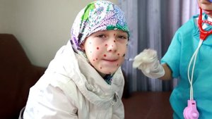 Играем в доктора #1 Лечение ветрянки Видео для детей