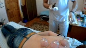 Хиджама  Кровопускание  Вакуумный массаж