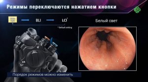 Как часто и кому следует пройти гастро и колоноскопию? Советы врача эндоскописта.