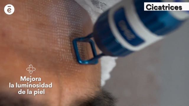 Mejora tus cicatrices con nuestro Láser Harmony XL Pro смотреть онлайн