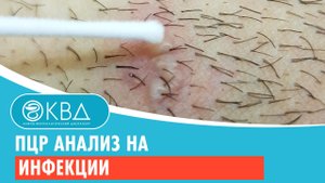 ✅ ПЦР анализ на инфекции. Клинический случай №191