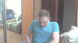 Мне поставили новые приемные гильзы для протезов бедра и голени.