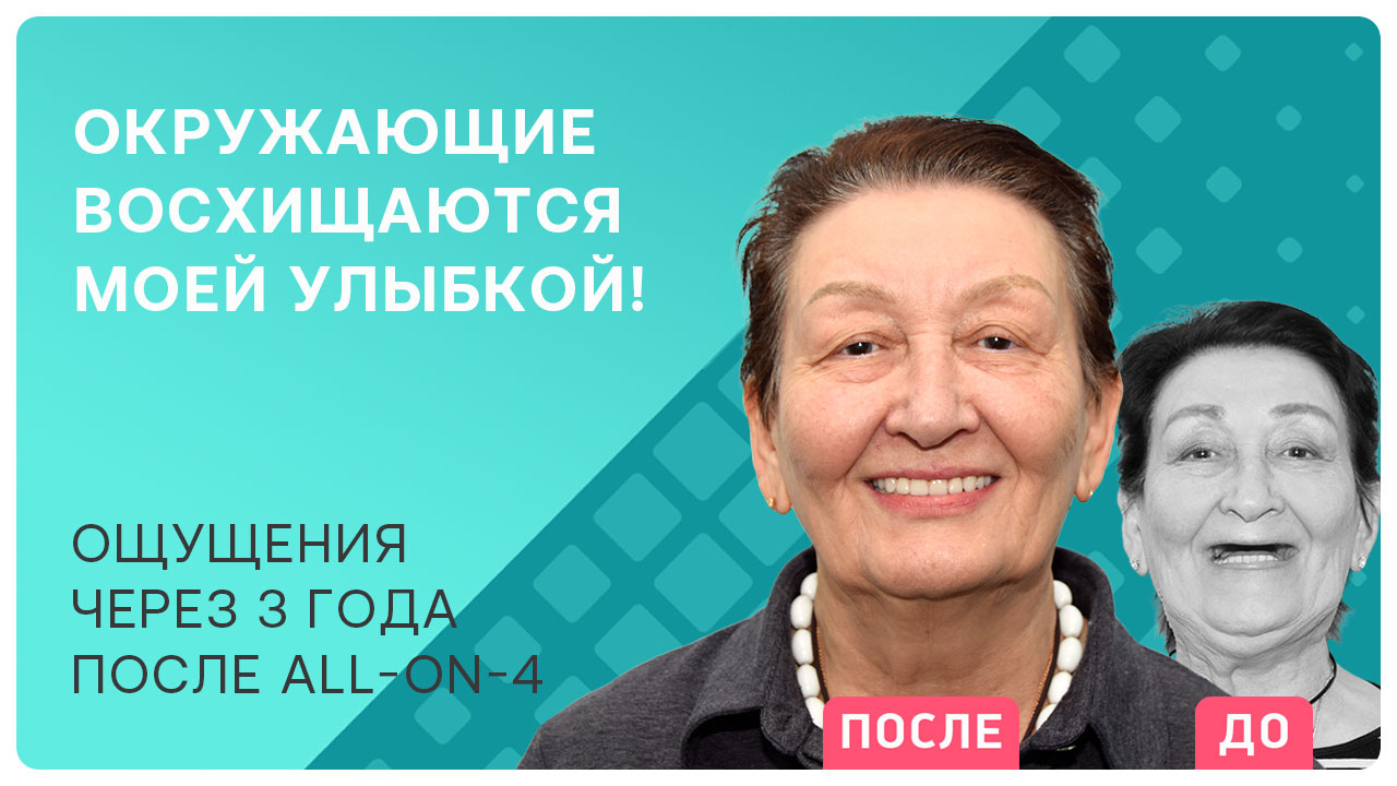 Почему врачи выбирают all-on-4? Личный опыт пациента и отзыв 3 года спустя