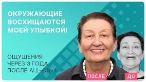 Почему врачи выбирают all-on-4? Личный опыт пациента и отзыв 3 года спустя