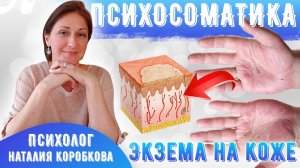 Экзема Психосоматика