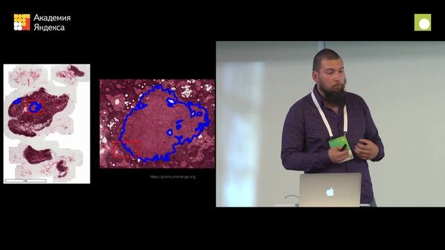 010. Машинное обучение в анализе медицинских данных — Иван Дрокин смотреть онлайн