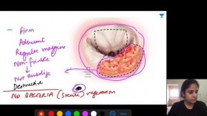 Mission FMGE Medicine in 10 Days :Cardiology | Let's Crack NEET PG | Dr.Jhanvi Bajaj