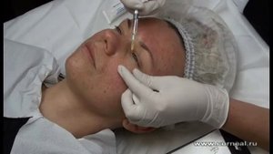 Биоревитализация - неспешная, но очень эффективная процедура