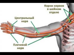 Во сне онемела рука - что делать?