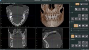 Основные инструменты для визуализации в One Volume Viewer