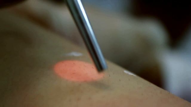 "La Lisa" Lazer Epliyasiya Mərkəzi - [www.OTV.az] смотреть онлайн