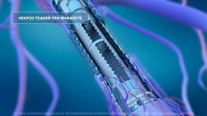 Повязка на ногу Варифорт RUS