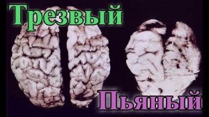 Вред алкоголя или как управлять пьяным народом.