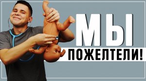 ЖЕЛТУХА НОВОРОЖДЕННЫХ: Лечение ЖЕЛТУХИ у младенцев на ДОМУ