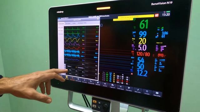 Monitor Mindray смотреть онлайн