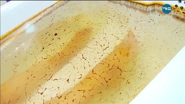 Нефтяные ванны в ОКБ1 смотреть онлайн