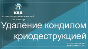 111  Удаление кондилом криодеструкцией