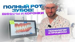 Полный рот зубов: Виниры и коронки. Лечение заняло 1 год. Стас Белоус Стоматолог Ульяновск