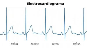 Animación electrocardiograma en Python - matplotlib.animation (Código en la descripción)