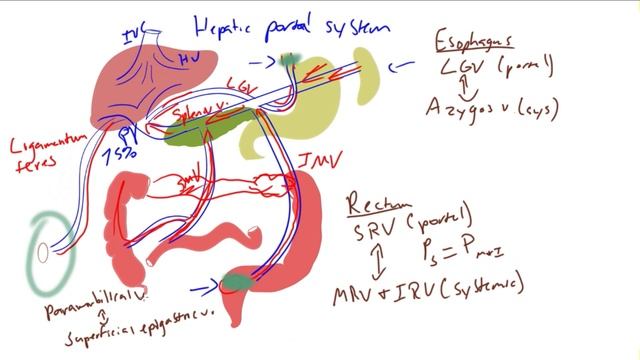 Portacaval Anastamosis/Caput Medusae/Varices MADE EASY! смотреть онлайн