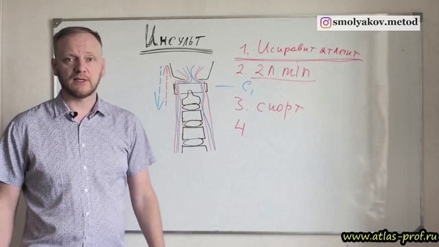 Профилактика инсульта