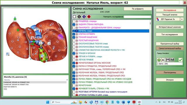 2024-07-23_143009-ПО Дианел®-2.1-действия по окончанию исследования - тест по пиктограмме