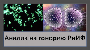 Анализ на гонорею реакция непрямой иммунофлюоресценции