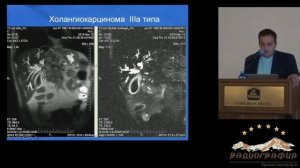 Гарик Оганисян. МР холангиография при диагностике заболеваний желчевыводящих путей.