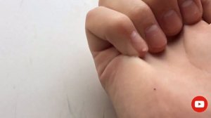 СКЛЕИЛ ПАЛЬЦЫ СУПЕР КЛЕЕМ